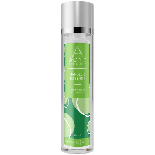 Mandelic Replenish (Mandelic Au Lait) 50 ml by Rhonda Allison